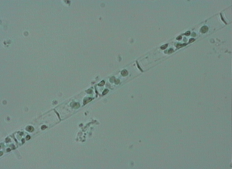 Dictyocha speculum
